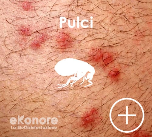Punture delle pulci come riconoscerle